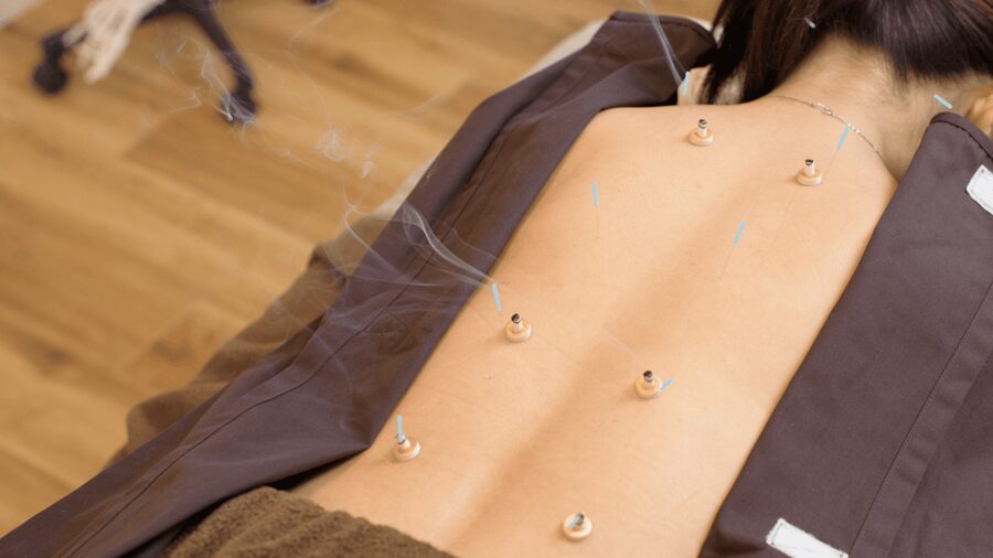 Hiroshima: Acupuncture and Japanese unique massage treatment - A practical option for couples and friends